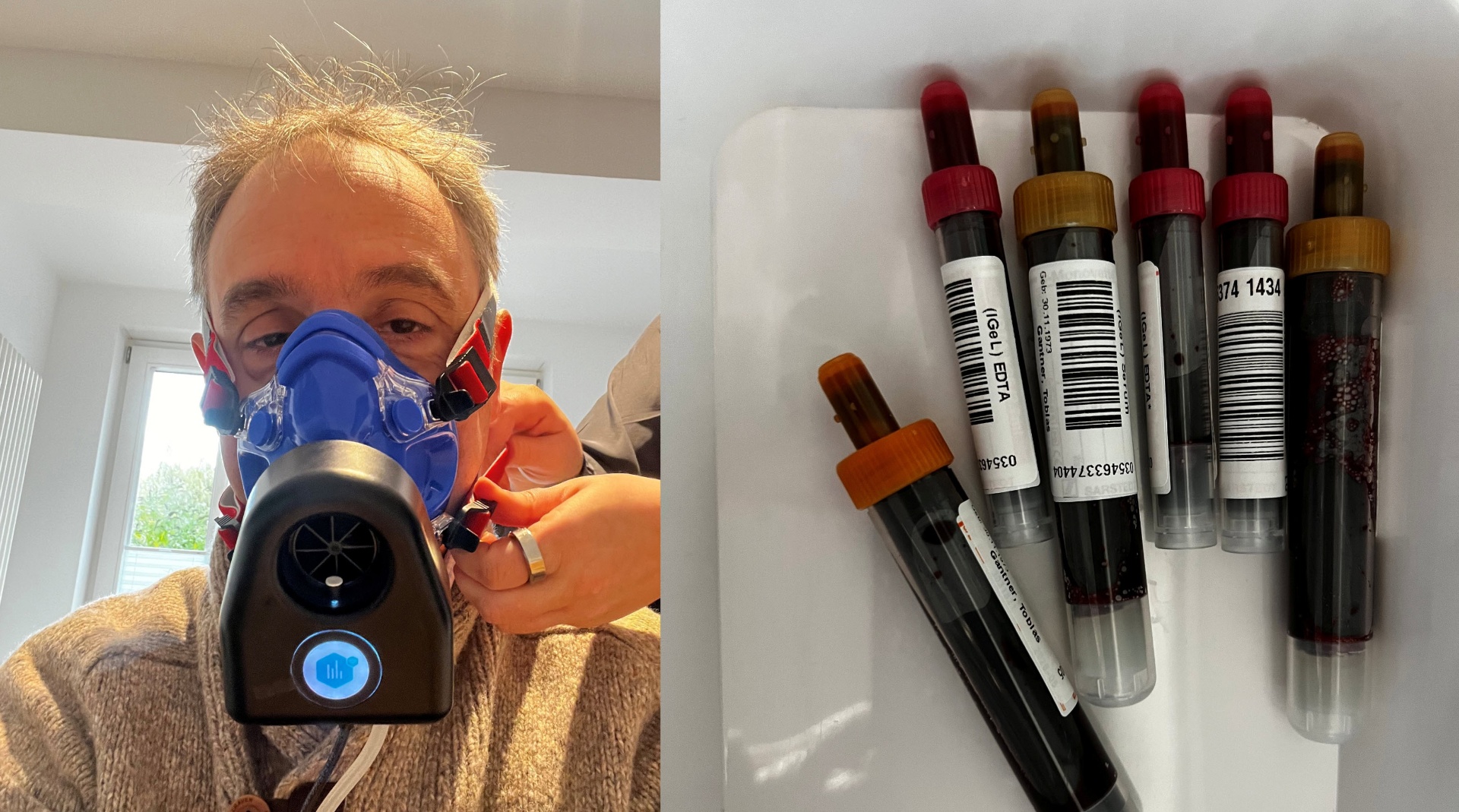 Spiroergometrie Test